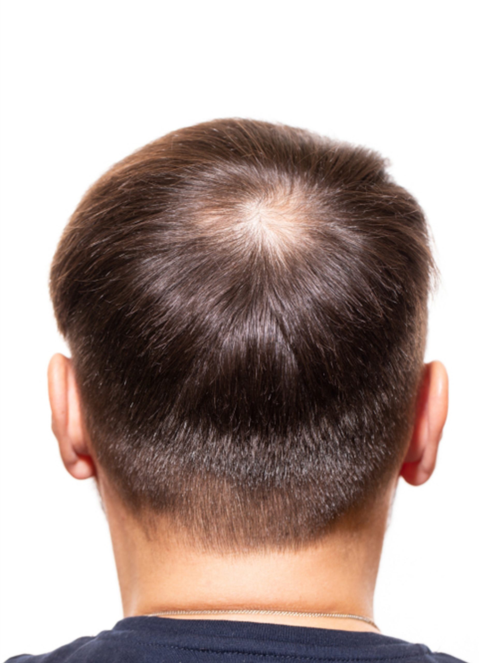 hair man 4
